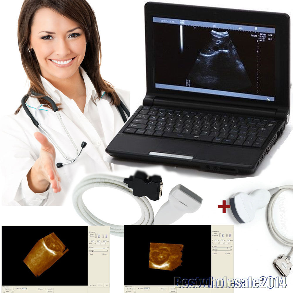 Digital Laptop Ultrasound Scanner/Machine Convex + Linear 2 Probes 3D Sale 190891237569 DIAGNOSTIC ULTRASOUND MACHINES FOR SALE