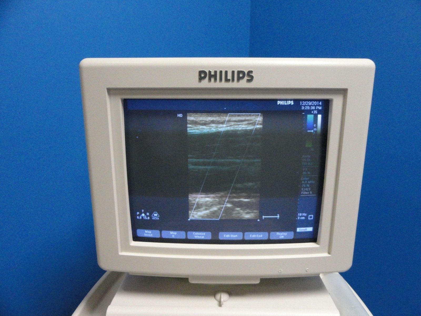 Philips 21390A / 15-6L Compact Linear Array Probe for HP HD7XE & EnVisor (8454) DIAGNOSTIC ULTRASOUND MACHINES FOR SALE