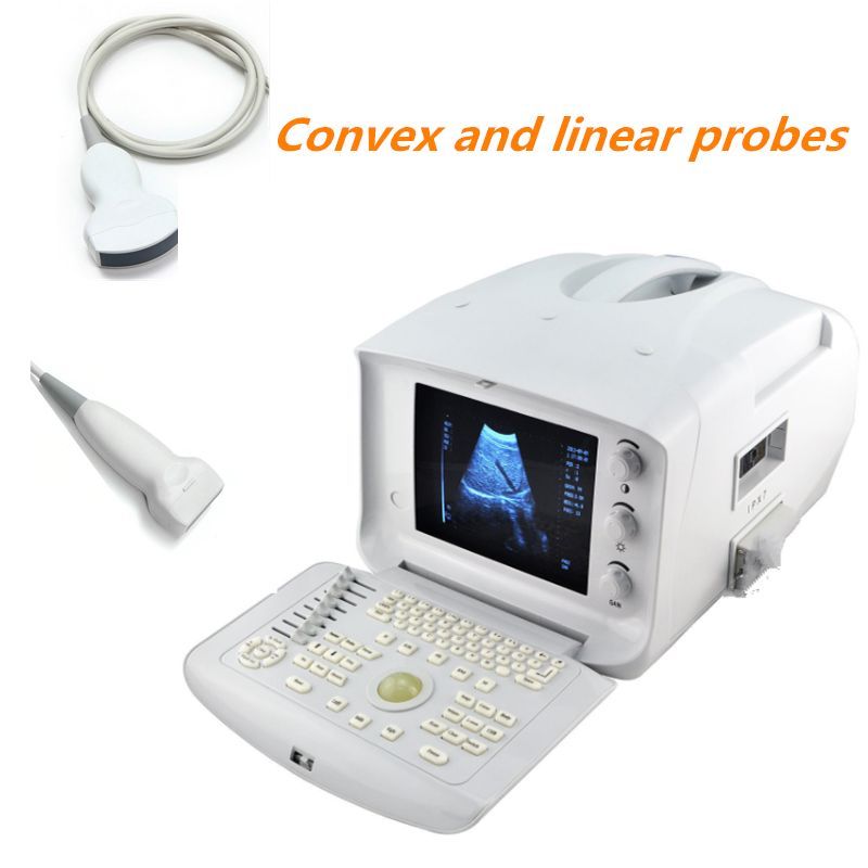 Digital Diagnose System Ultrasound Scanner Monitor Convex+Linear Probe 3D Image DIAGNOSTIC ULTRASOUND MACHINES FOR SALE