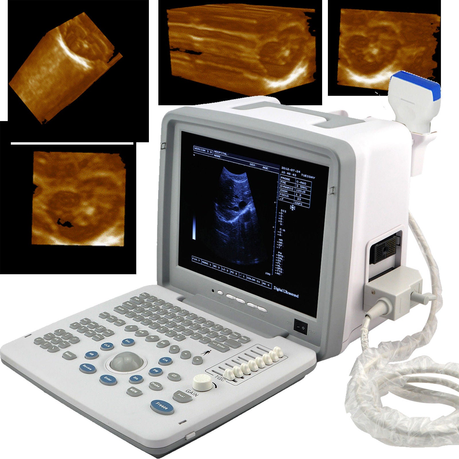 Full Digital Portable Ultrasound Scanner w multi-frequency 7.5 linear Probe w 3D DIAGNOSTIC ULTRASOUND MACHINES FOR SALE