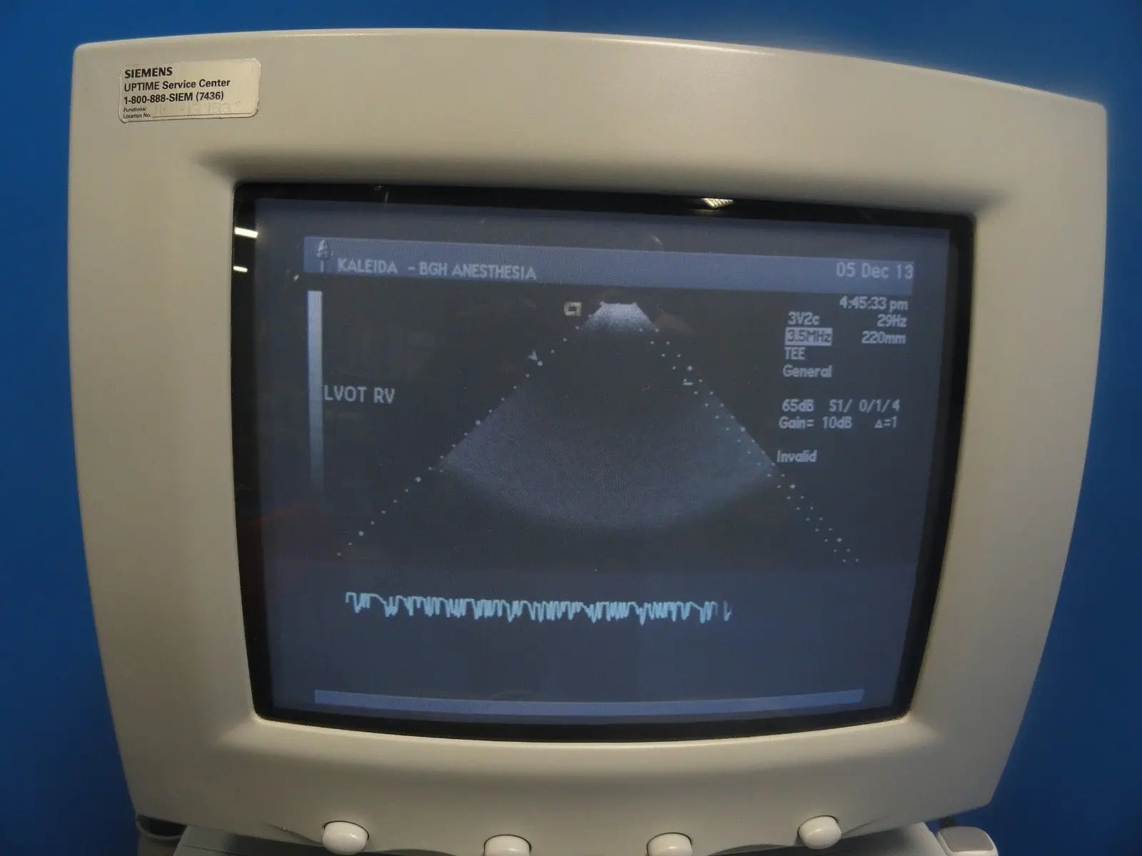 2002 Acuson Sequoia C256 Cardiac Ultrasound W/ 5V2C Probe Printer & VCR (6066) DIAGNOSTIC ULTRASOUND MACHINES FOR SALE