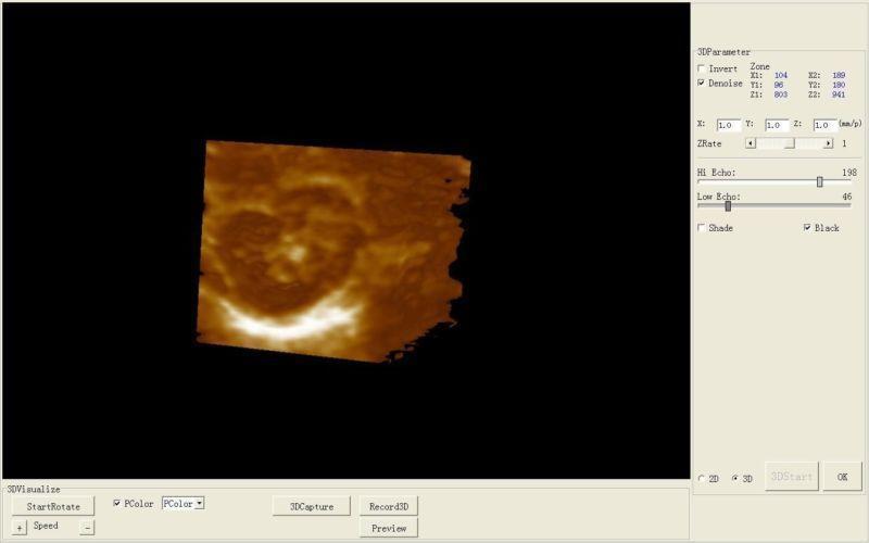veterinary Laptop Vet Ultrasound Scanner Machine Animal Rectal probe 3D Sale 190891379269 DIAGNOSTIC ULTRASOUND MACHINES FOR SALE