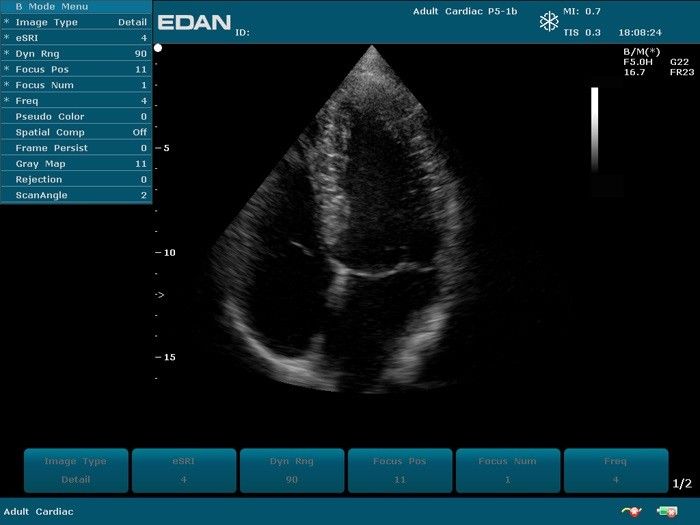 Edan U50 Prime Veterinary Ultrasound Machine. Microconvex & Phased Array Probes. DIAGNOSTIC ULTRASOUND MACHINES FOR SALE