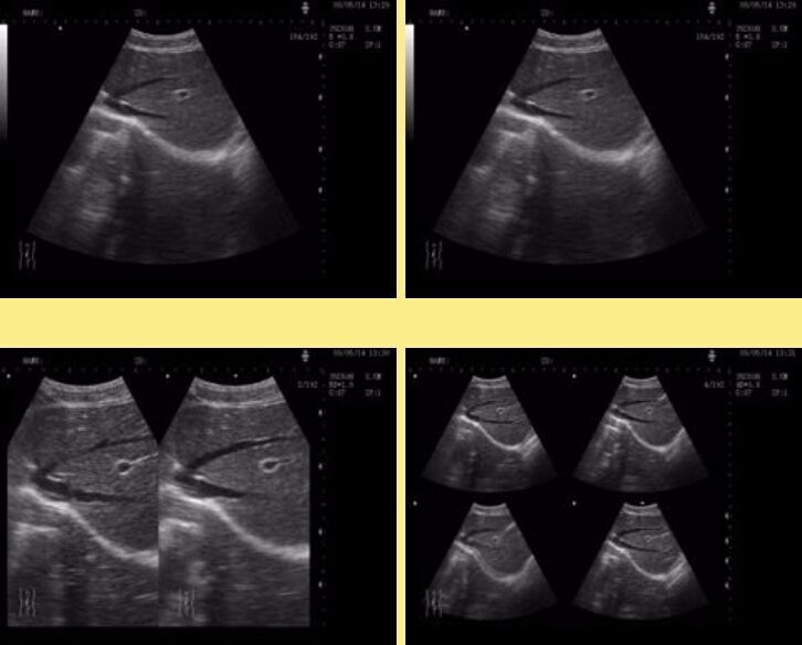 Portable Ultrasound Ultrasound Scanner Convex Linear Transvaginal 3 Probes 3D A+ 190891445834 DIAGNOSTIC ULTRASOUND MACHINES FOR SALE