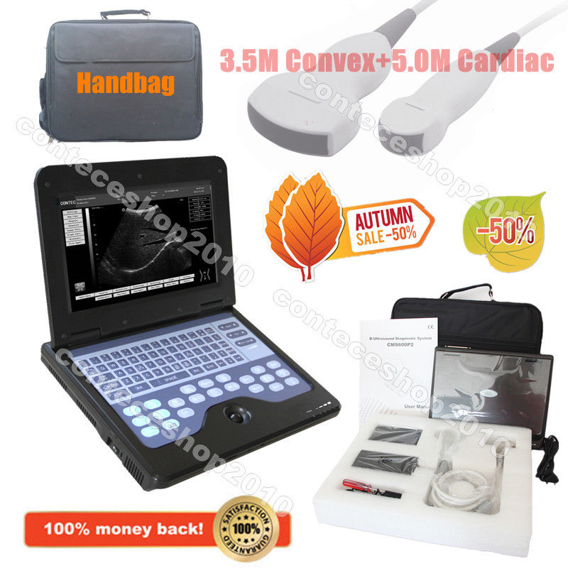 Portable Laptop Machine Digital Ultrasound Scanner, probe, human/vet, USA Fedex DIAGNOSTIC ULTRASOUND MACHINES FOR SALE