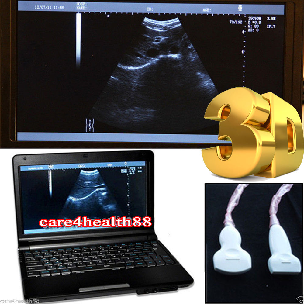 Full Digital Laptop Ultrasound Scanner 2 Probes Covex + Linear Probes 3D Precise 190891802569 DIAGNOSTIC ULTRASOUND MACHINES FOR SALE