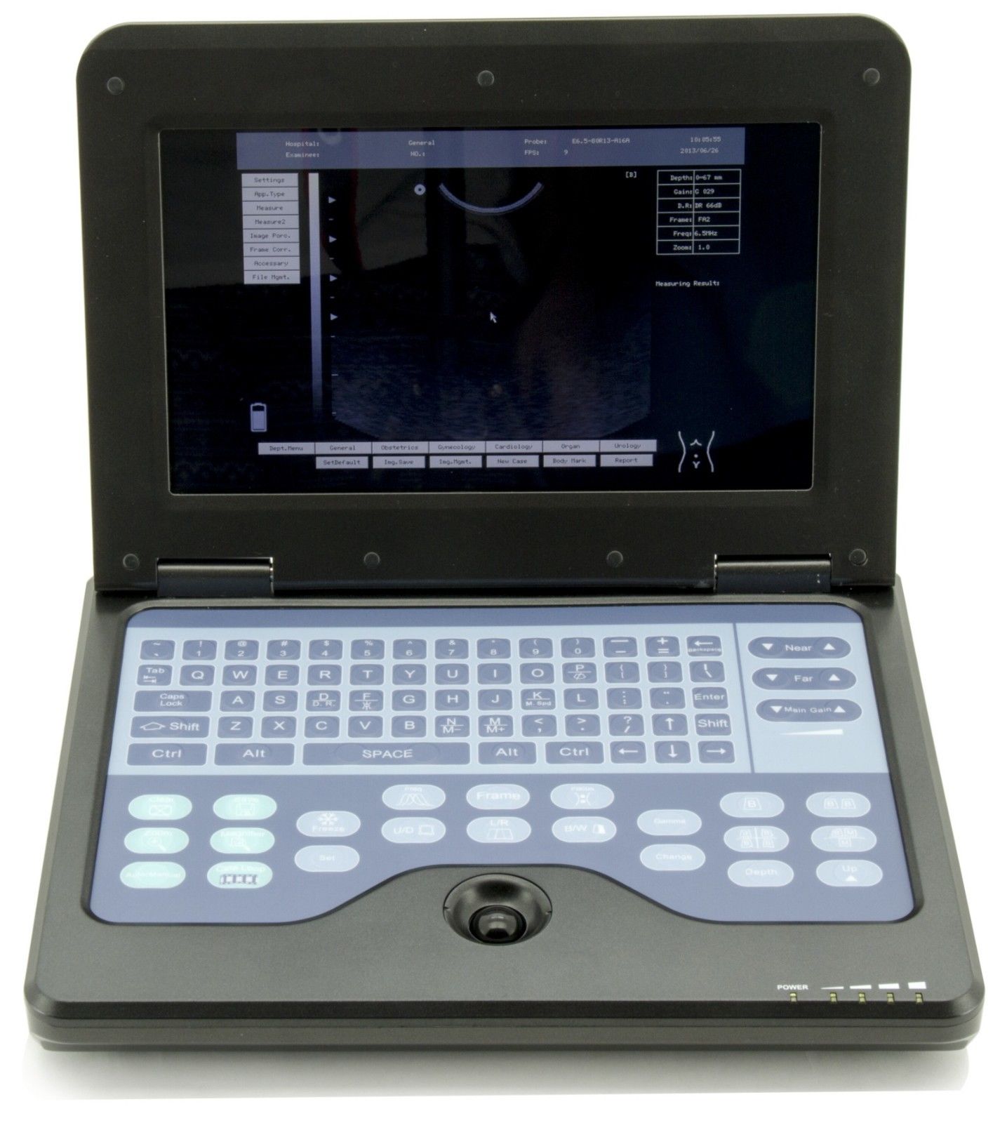 US Veterinary equine& Bovine Ultrasound Scanner 7.5M Rectal Probe VET laptop CE 658126921220 DIAGNOSTIC ULTRASOUND MACHINES FOR SALE