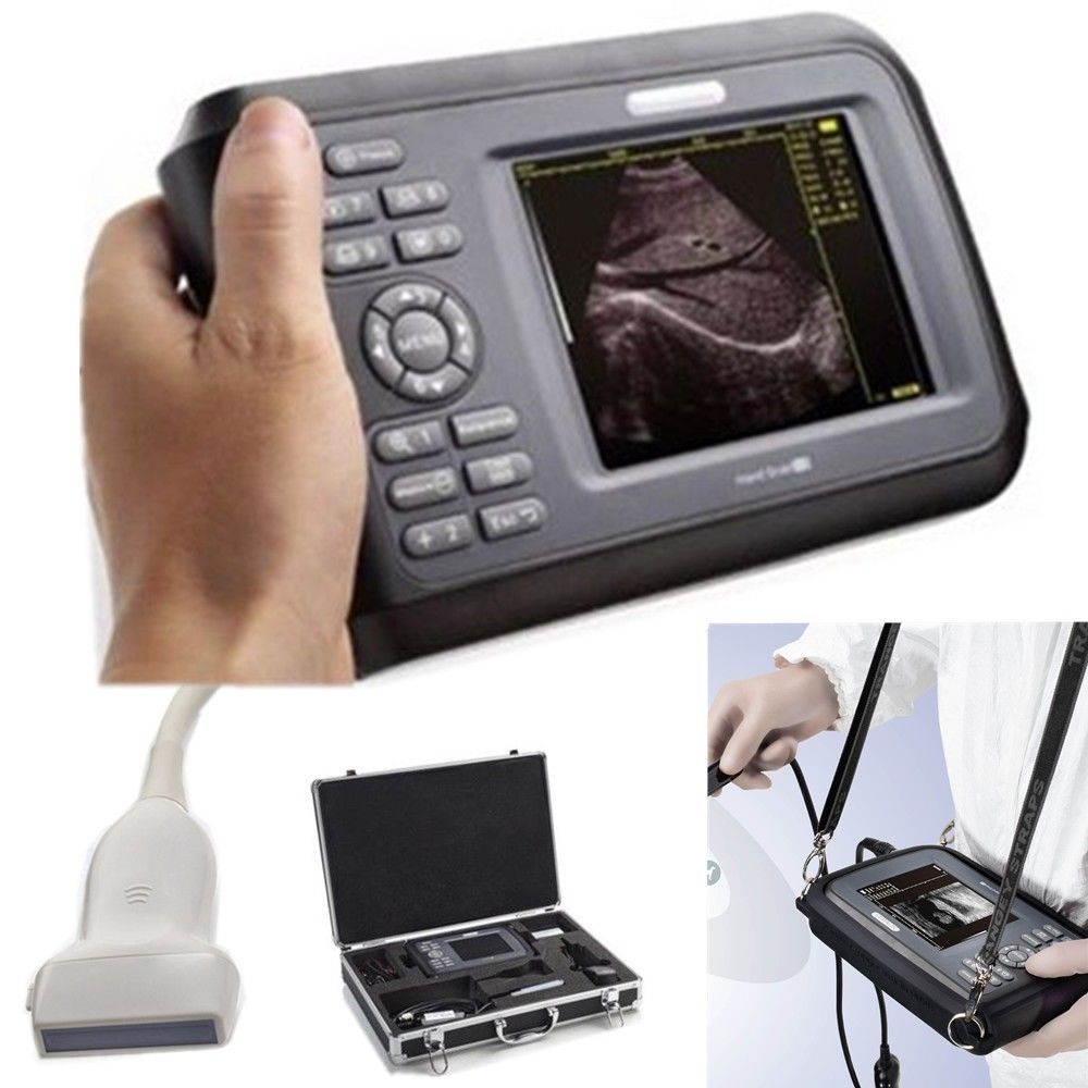 Laptop HandScan Digital Ultrasound Scanner system 7.5Mhz Linear Probe + Case 190891758767 DIAGNOSTIC ULTRASOUND MACHINES FOR SALE