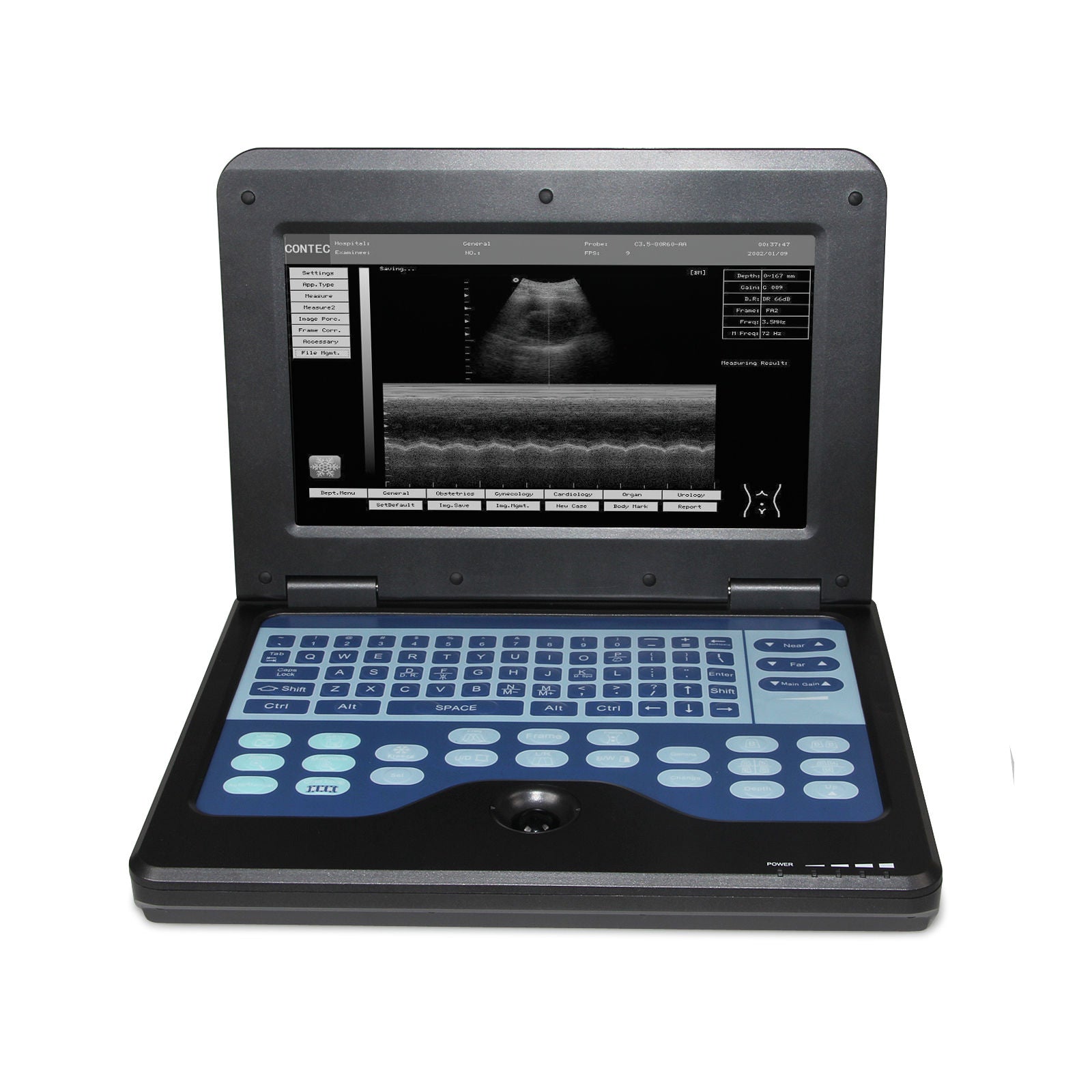 US Seller CE Veterinary Laptop Machine Ultrasound scanner Vet 7.5M Rectal Probe 658126923446 DIAGNOSTIC ULTRASOUND MACHINES FOR SALE