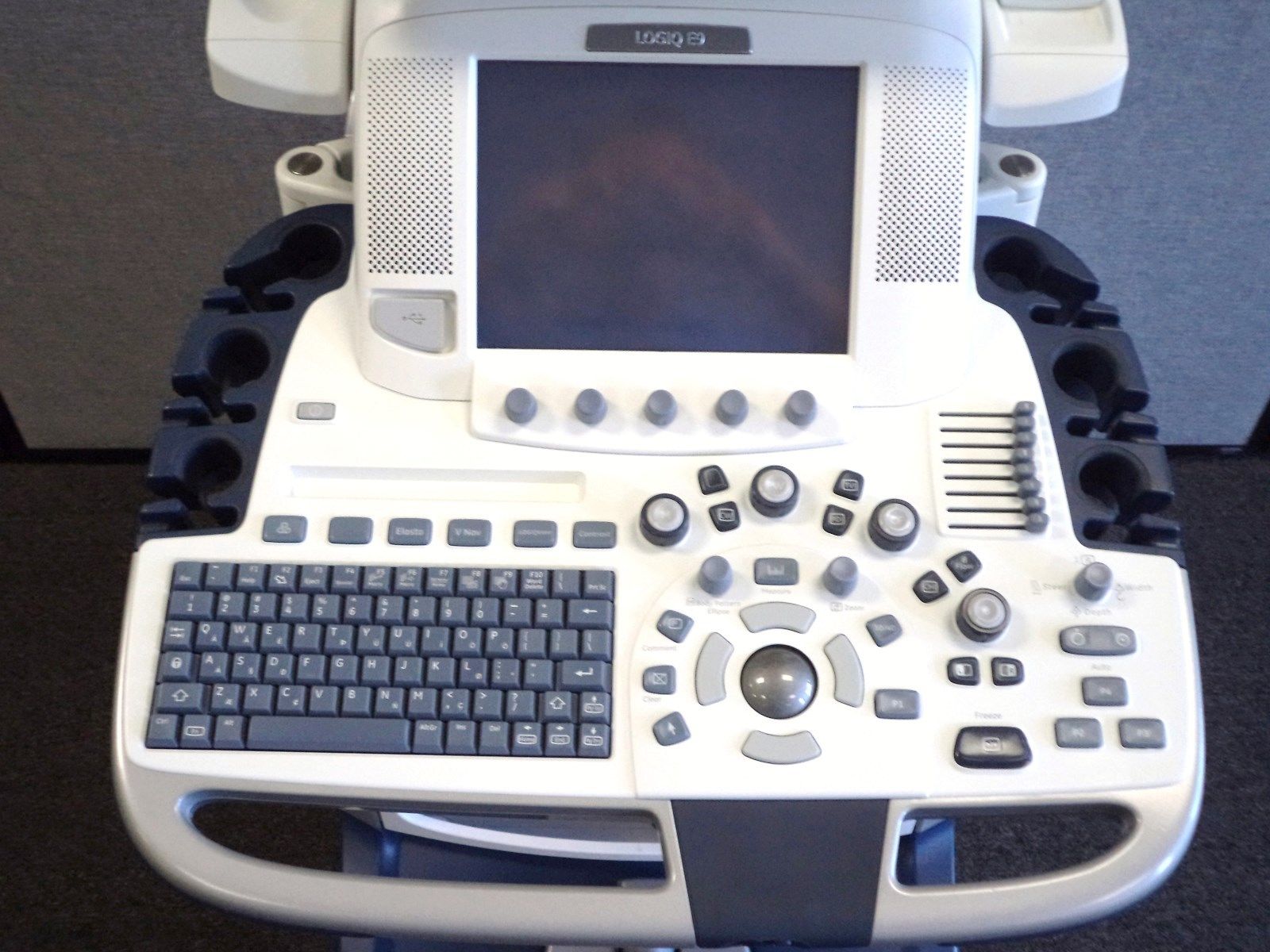 GE Logiq E9 Ultrasound System Excellent Scanner DIAGNOSTIC ULTRASOUND MACHINES FOR SALE
