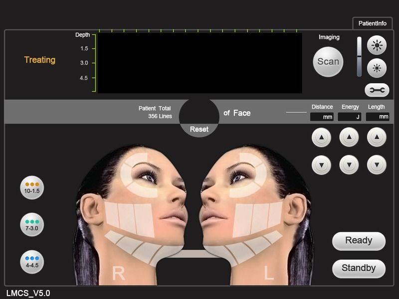 HIFU High Intensity Focused Ultrasound Ultrasonic Hifu Machine Face Lifting DIAGNOSTIC ULTRASOUND MACHINES FOR SALE