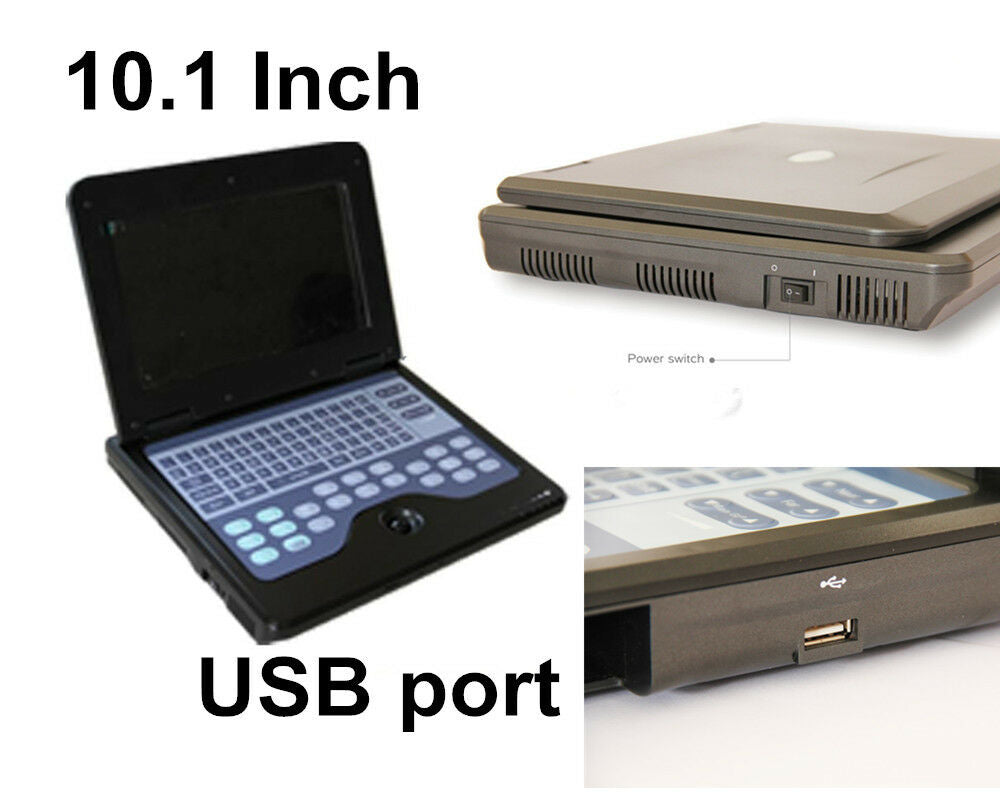 Portable Laptop Ultrasound Scanner Machine Human 2 Probes 3.5 Convex+ 7.5 Linear DIAGNOSTIC ULTRASOUND MACHINES FOR SALE
