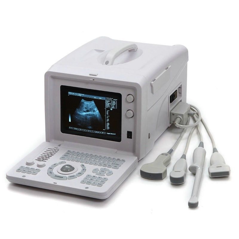 Ultrasonic Ultrasound Scanner Ultrasound Scanning+7.5Mhz Linear Array probe CE DIAGNOSTIC ULTRASOUND MACHINES FOR SALE