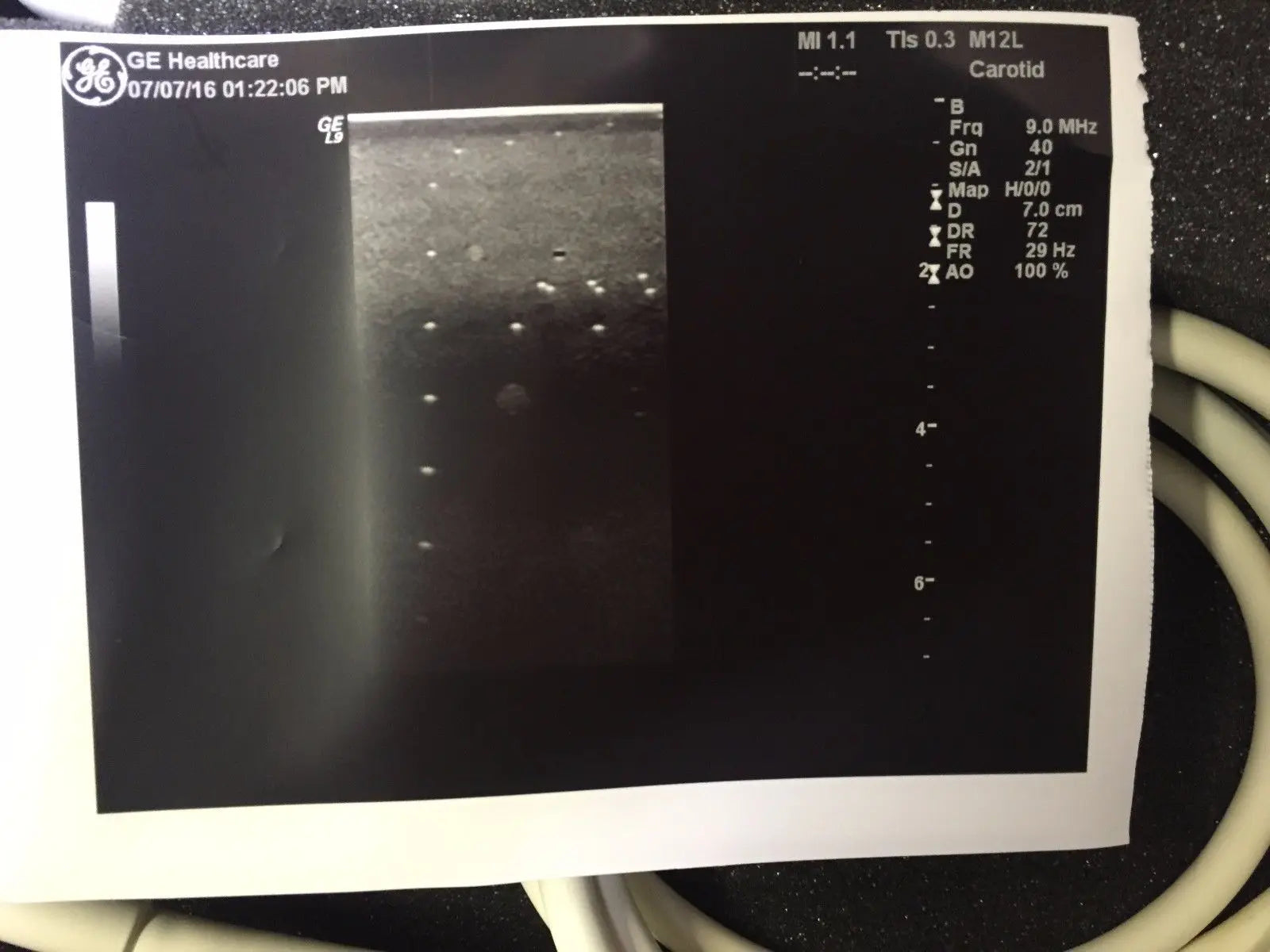 GE M12L Ultrasound Transducer for GE Logiq Systems DIAGNOSTIC ULTRASOUND MACHINES FOR SALE