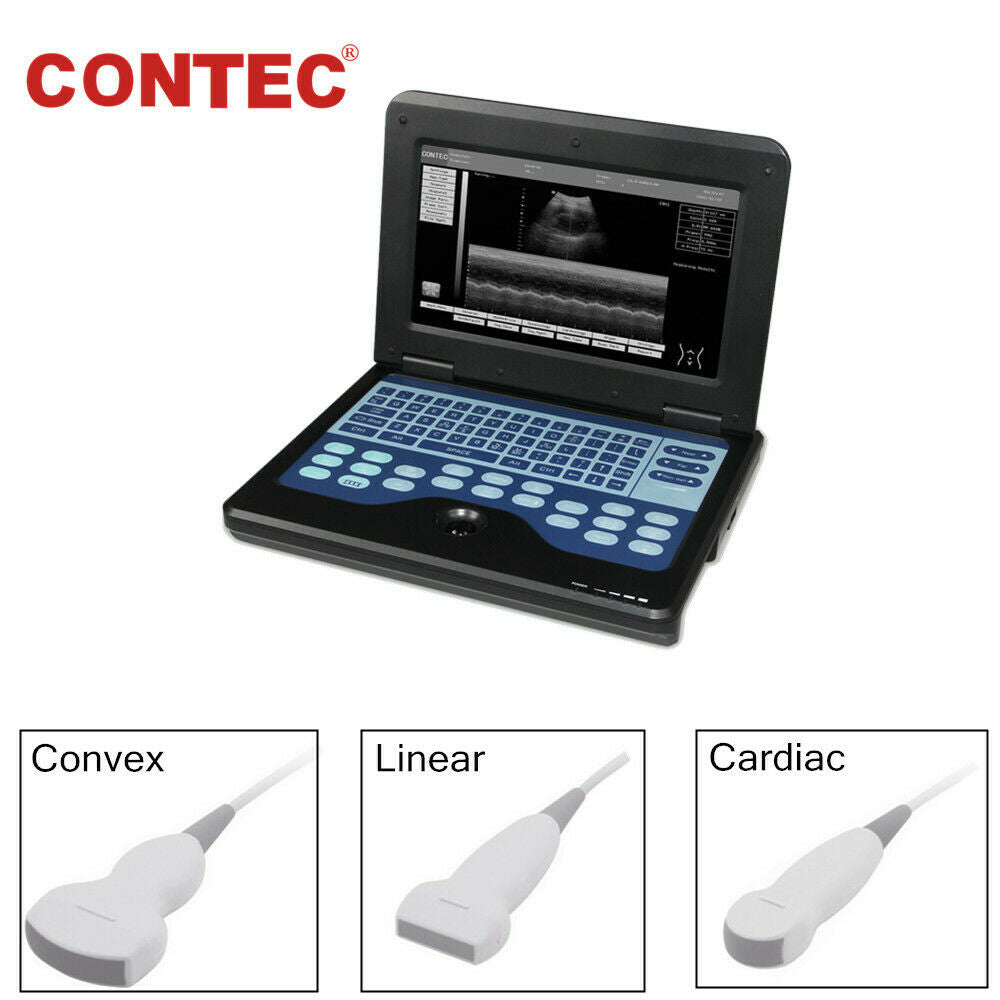 Portable Ultrasound Scanner Ultrasonograph Machine 3 Probe Convex Linear Cardiac 670924011996 DIAGNOSTIC ULTRASOUND MACHINES FOR SALE