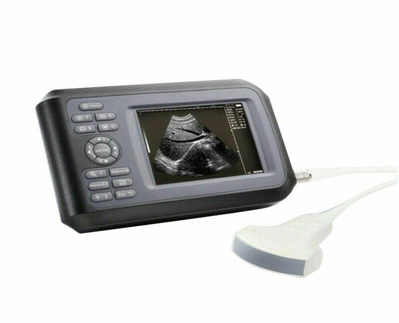 Handscan Ultrasound Scanner Machine Digital For Human Use 3.5Mhz Convex Probe US DIAGNOSTIC ULTRASOUND MACHINES FOR SALE
