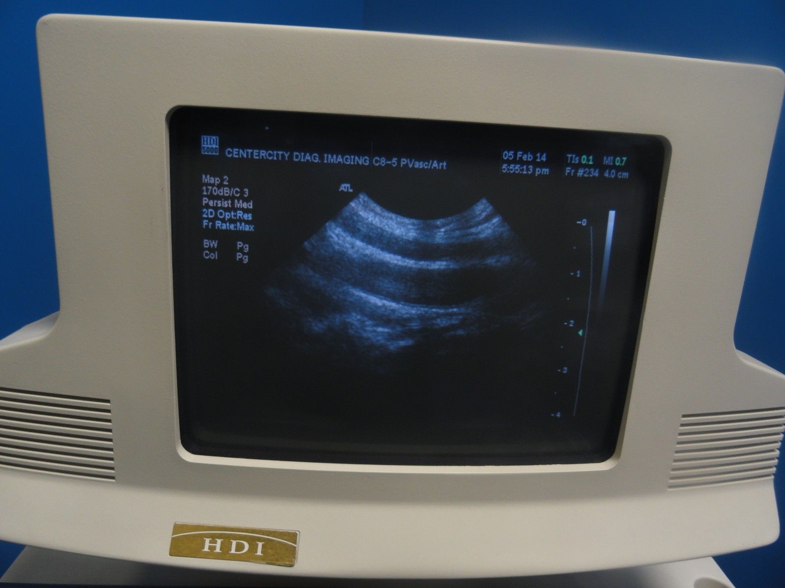 ATL C8-5 14R Micro-Convex 8.0-5.0 MHz Ultrasound Probe (6306) DIAGNOSTIC ULTRASOUND MACHINES FOR SALE