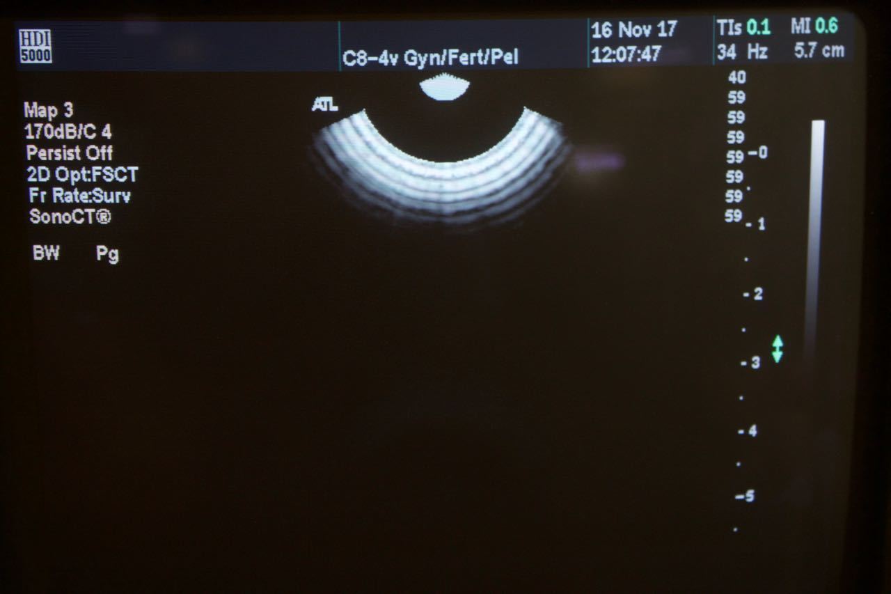 Philips ATL C8-4v Curved Array IVT Ultrasound Transducer HDI5000 4000-0409-04 DIAGNOSTIC ULTRASOUND MACHINES FOR SALE