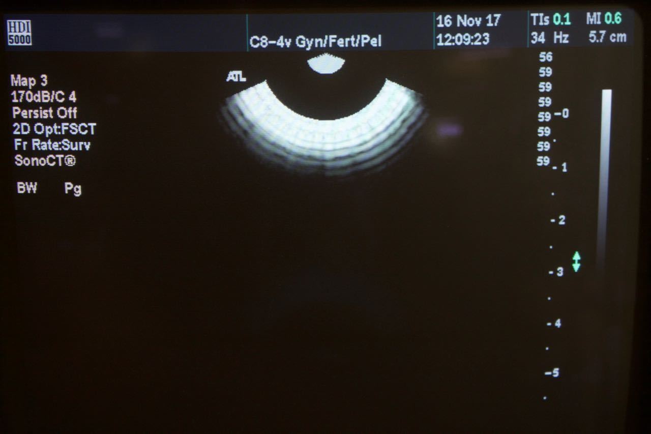 Philips ATL C8-4v Curved Array IVT Ultrasound Transducer HDI5000 4000-0409-04 DIAGNOSTIC ULTRASOUND MACHINES FOR SALE