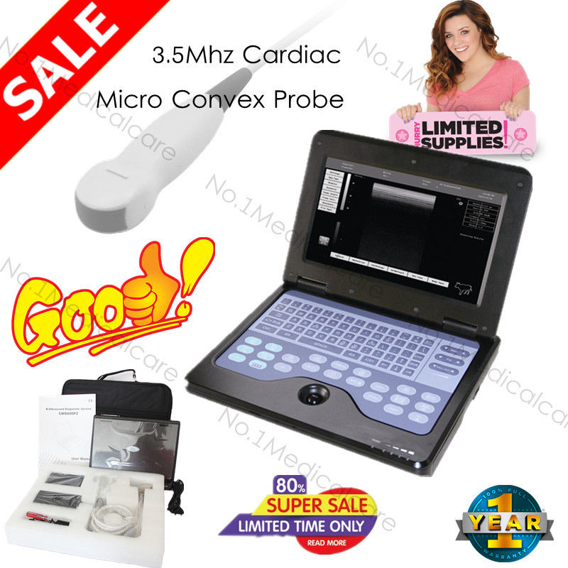 Portable laptop machine digital ultrasound scanner+probe for human,USA Warehouse DIAGNOSTIC ULTRASOUND MACHINES FOR SALE