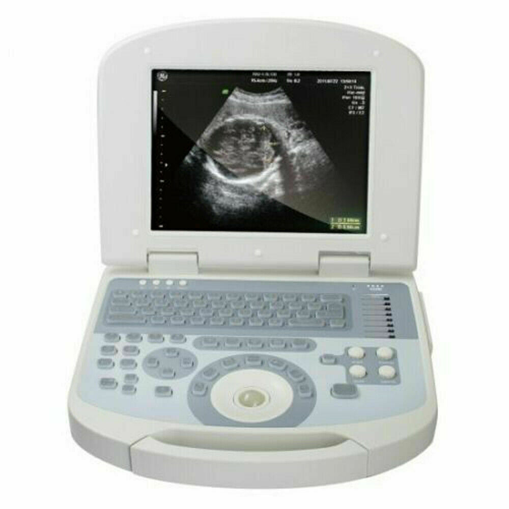 Portable Digital Laptop Medical Ultrasound Scanner Machine+3.5 Convex probe+Gift DIAGNOSTIC ULTRASOUND MACHINES FOR SALE