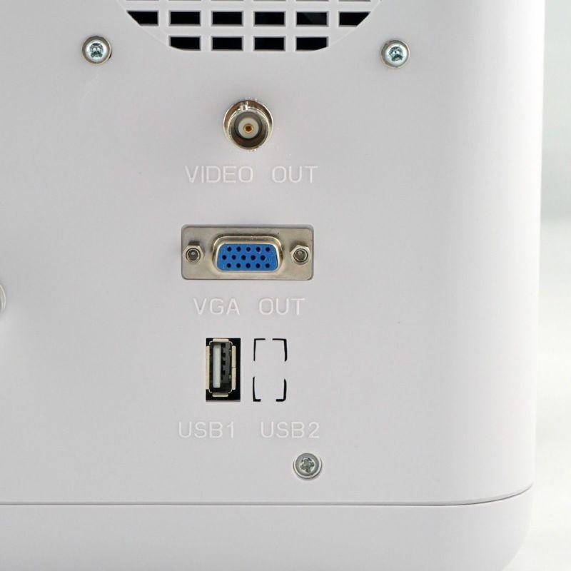 FAST 12'' Ultrasound Scanner Digital Machine+3D Image+Convex &Linear 2 Probes 190891919595 DIAGNOSTIC ULTRASOUND MACHINES FOR SALE