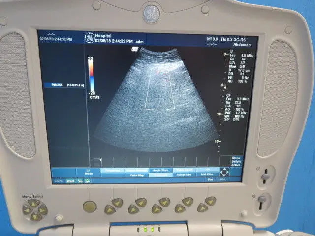GE Logiq Book XP 3C-RS Ultrasound Probe Transducer 2333880 DIAGNOSTIC ULTRASOUND MACHINES FOR SALE