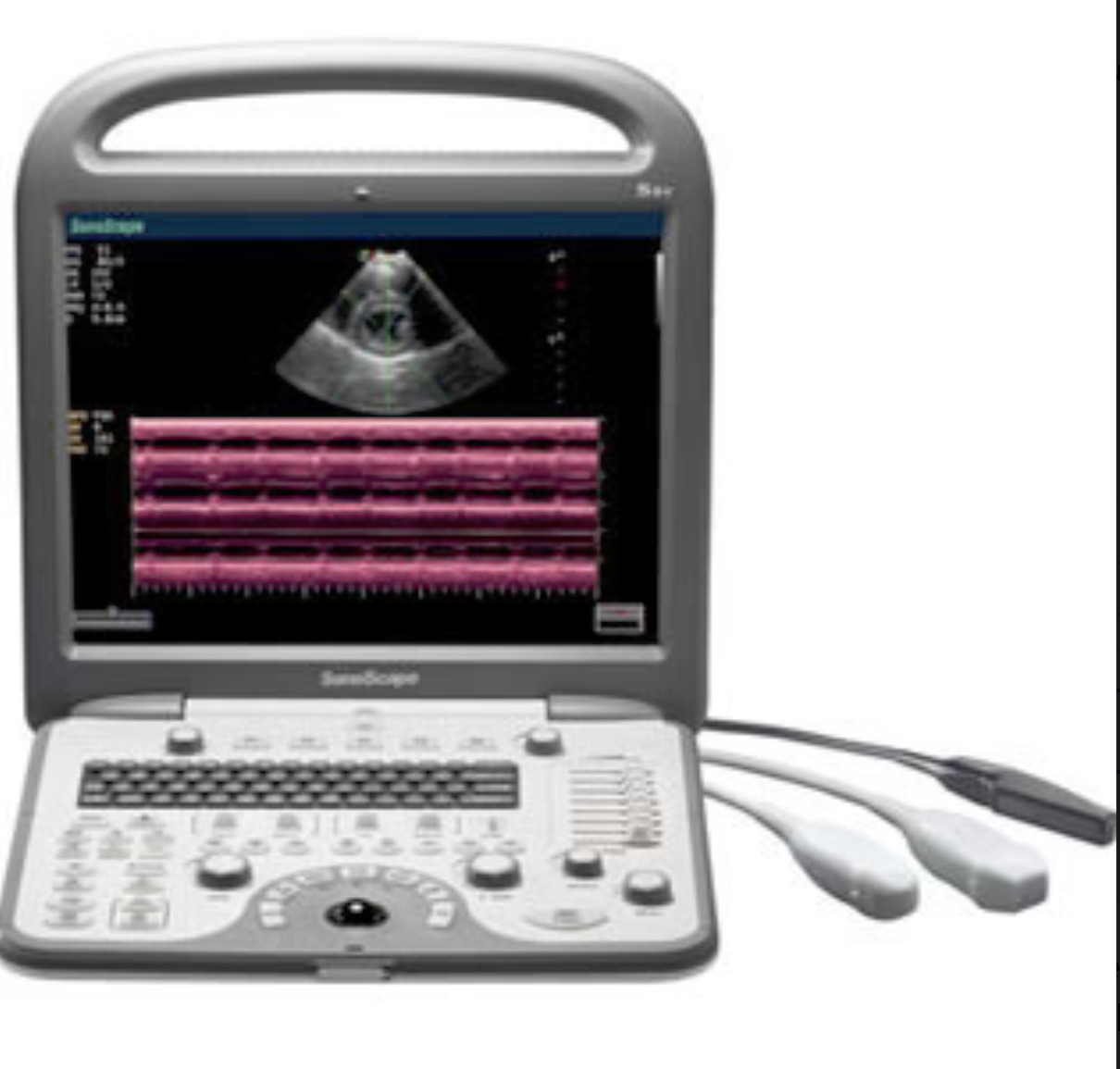 SonoScape S8 with Micro Convex C611 Probe for Small Animals Warranty 1 Year DIAGNOSTIC ULTRASOUND MACHINES FOR SALE