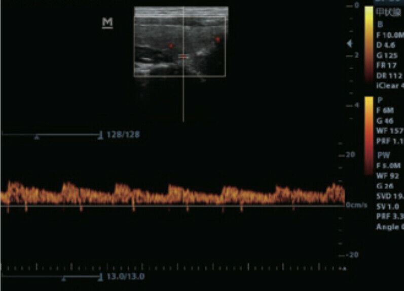 Veterinary Color Doppler Ultrasound & Micro convex probe for Small animals DIAGNOSTIC ULTRASOUND MACHINES FOR SALE