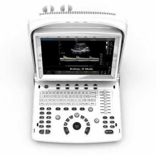 Portable Ultrasound, Chison ECO3, Amazing Quality with Two Probes DIAGNOSTIC ULTRASOUND MACHINES FOR SALE