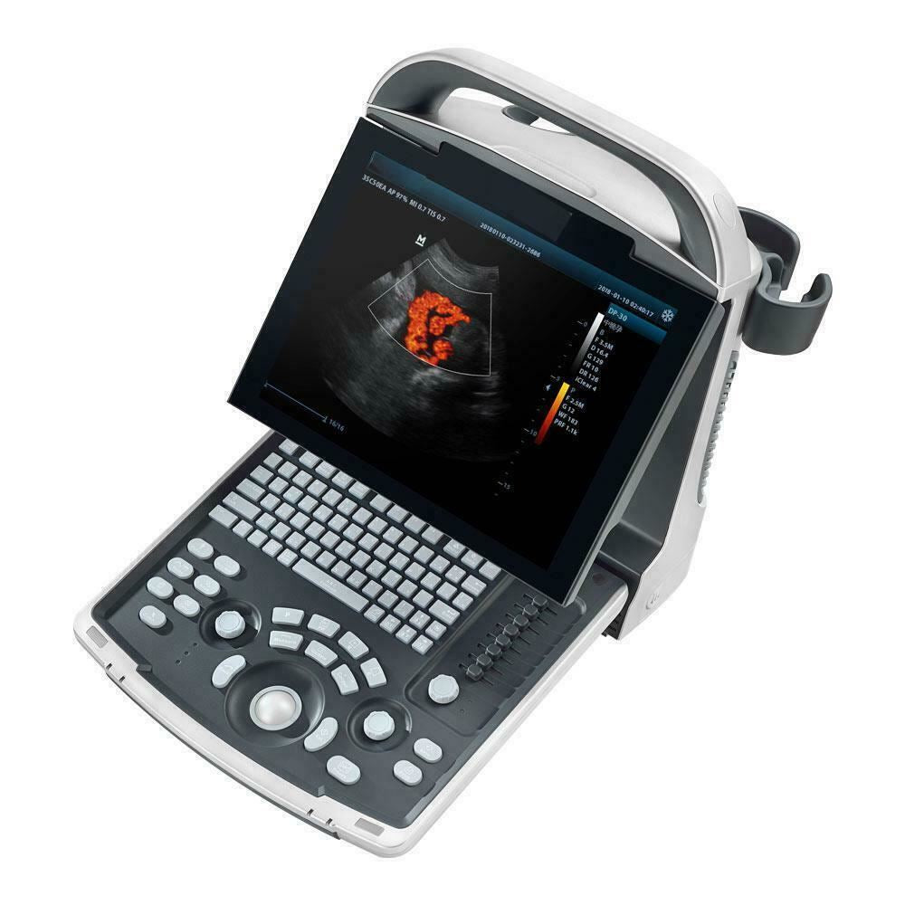 Most Affordable Color Doppler Ultrasound with One Probe LED,THI DIAGNOSTIC ULTRASOUND MACHINES FOR SALE