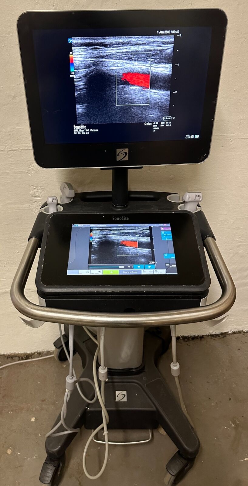 Sonosite X-Porte Ultrasound without probes manufactured 2021 with 3 Probes DIAGNOSTIC ULTRASOUND MACHINES FOR SALE