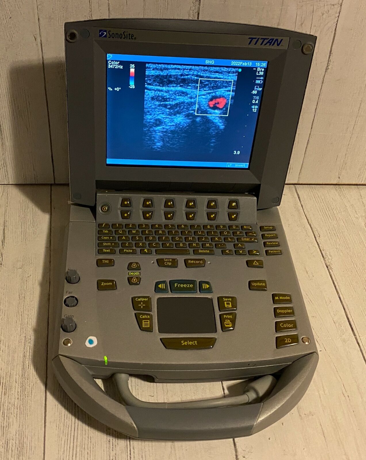 Sonosite Titan Portable Ultrasound 2005 - Main unit DIAGNOSTIC ULTRASOUND MACHINES FOR SALE