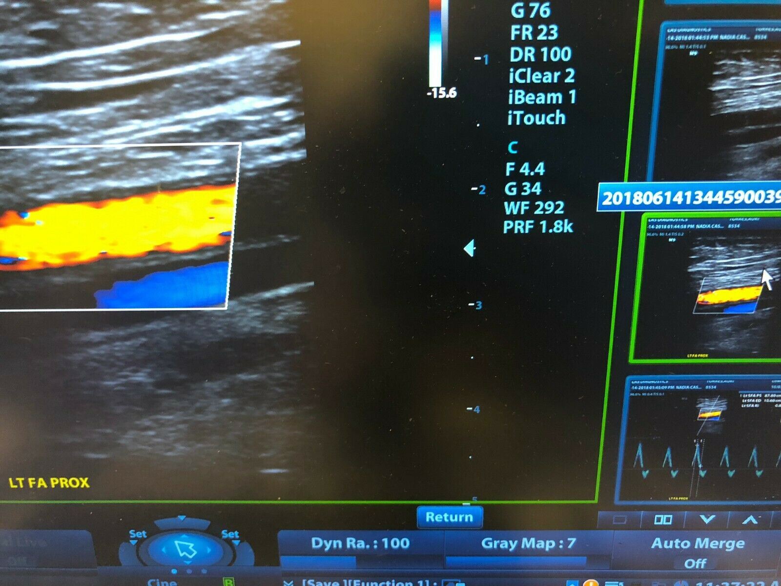 Mindray M9 Portable Ultrasound With  Two Probes (L12-4S) (C5-1S) DOM 2015 DIAGNOSTIC ULTRASOUND MACHINES FOR SALE