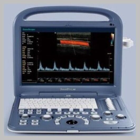 SonoScape S2 with convex Probe Abdominal Ultrasound DIAGNOSTIC ULTRASOUND MACHINES FOR SALE