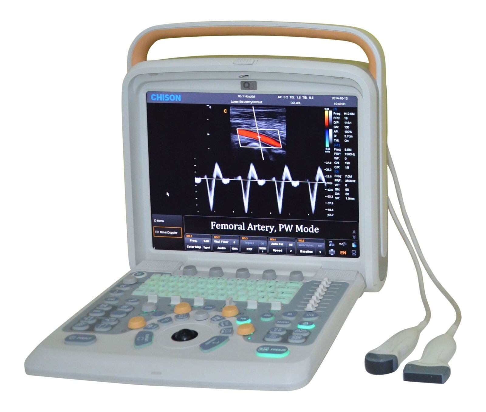 Chison Q5Vet Veterinary Color Doppler Ultrasound Machine, Equipment - Low Price DIAGNOSTIC ULTRASOUND MACHINES FOR SALE