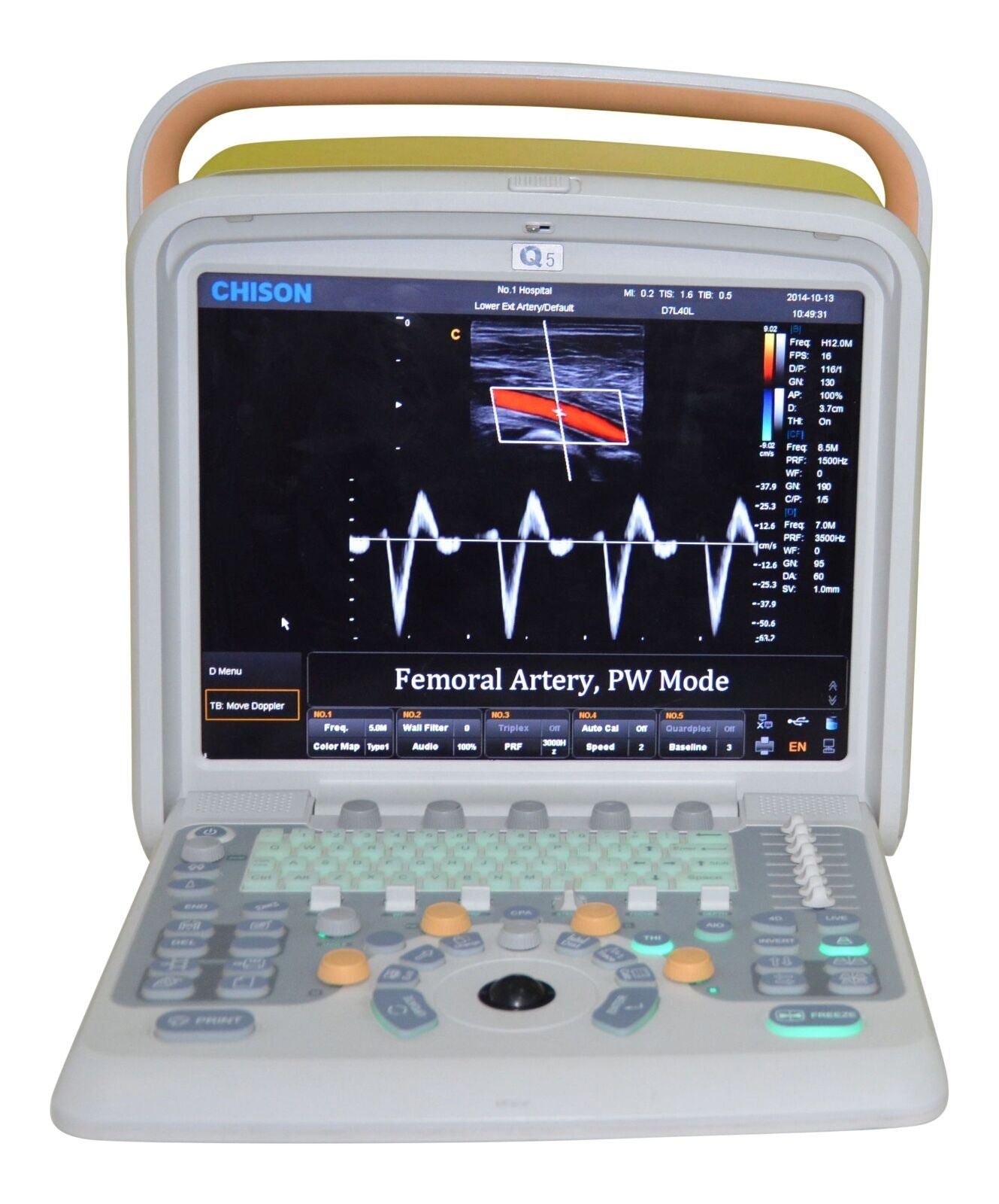 Chison Q5Vet Veterinary Color Doppler Ultrasound Machine, Equipment - Low Price DIAGNOSTIC ULTRASOUND MACHINES FOR SALE