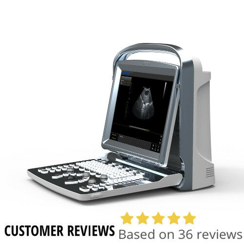 Chison ECO1 Portable Ultrasound Machine, Quality, LED, Linear & Printer Included DIAGNOSTIC ULTRASOUND MACHINES FOR SALE