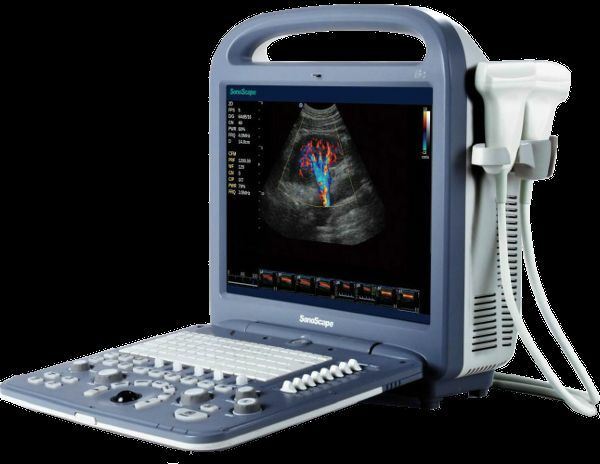 SonoScape S2 with one Linear array  Probe L741  5.0-10.0 Mhz DIAGNOSTIC ULTRASOUND MACHINES FOR SALE