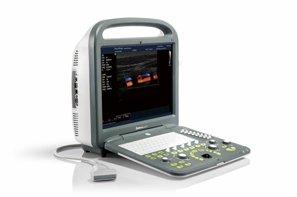 SonoScape S8 Farbe Doppler Tragbar Ultraschall & Lineare Anordnung Sonde L743 DIAGNOSTIC ULTRASOUND MACHINES FOR SALE