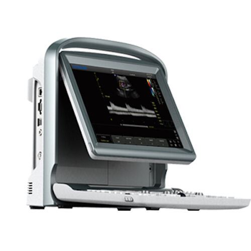 Color Doppler Vascular Ultrasound Scanner with fourProbes, Battery - Chison ECO5 DIAGNOSTIC ULTRASOUND MACHINES FOR SALE