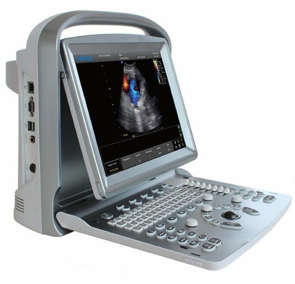 Color Doppler Vascular Ultrasound Scanner with Two Probes, Battery - Chison ECO5 DIAGNOSTIC ULTRASOUND MACHINES FOR SALE