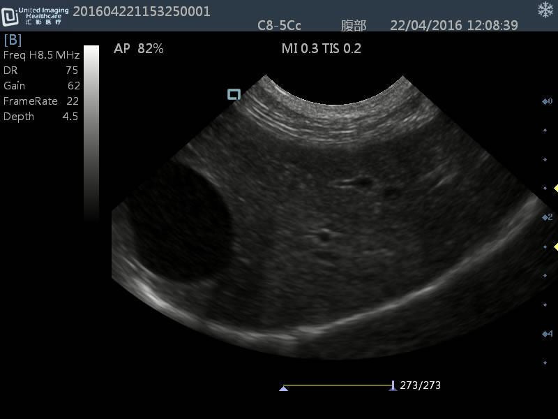 Quality DP30 Veterinary Ultrasound 12" Screen & Rectal Probe, 50L60EAV DIAGNOSTIC ULTRASOUND MACHINES FOR SALE