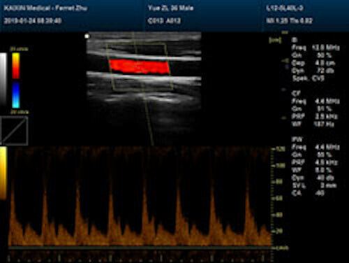 Quality Large Animal Veterinary Color Doppler Ultrasound & Micro convex Probe DIAGNOSTIC ULTRASOUND MACHINES FOR SALE