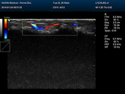 Quality Large Animal Veterinary Color Doppler Ultrasound & Micro convex Probe DIAGNOSTIC ULTRASOUND MACHINES FOR SALE