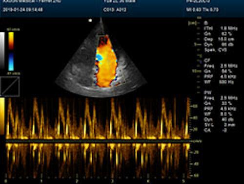 Quality Large Animal Veterinary Color Doppler Ultrasound & Micro convex Probe DIAGNOSTIC ULTRASOUND MACHINES FOR SALE