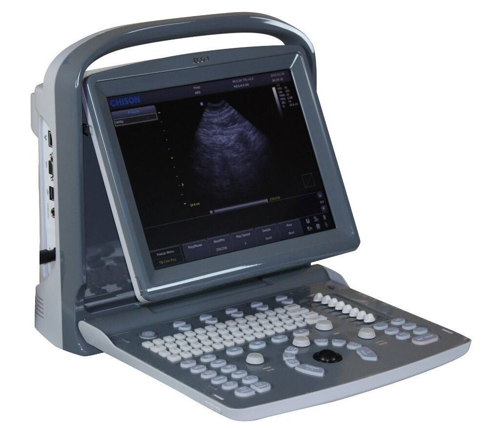 Chison ECO1 Portable LED Ultrasound Scanner, Quality and Affordable DIAGNOSTIC ULTRASOUND MACHINES FOR SALE