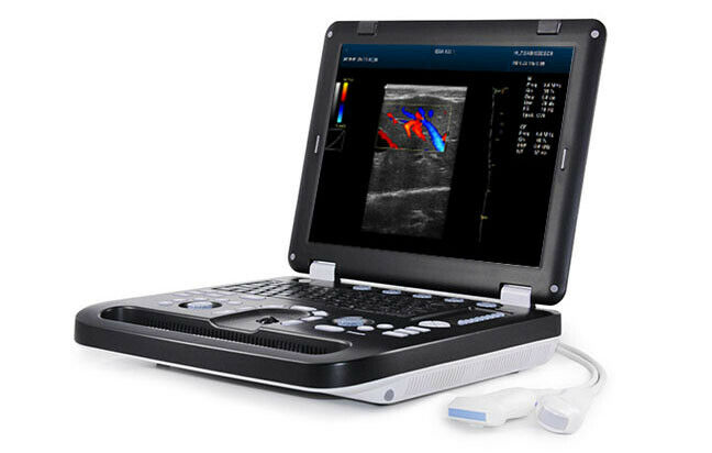 Newest- Farbe Tragbar Ultraschall & Ein Sonde, Dicom , LED Display DIAGNOSTIC ULTRASOUND MACHINES FOR SALE