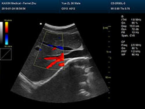 Newest- Farbe Tragbar Ultraschall & Ein Sonde, Dicom , LED Display DIAGNOSTIC ULTRASOUND MACHINES FOR SALE