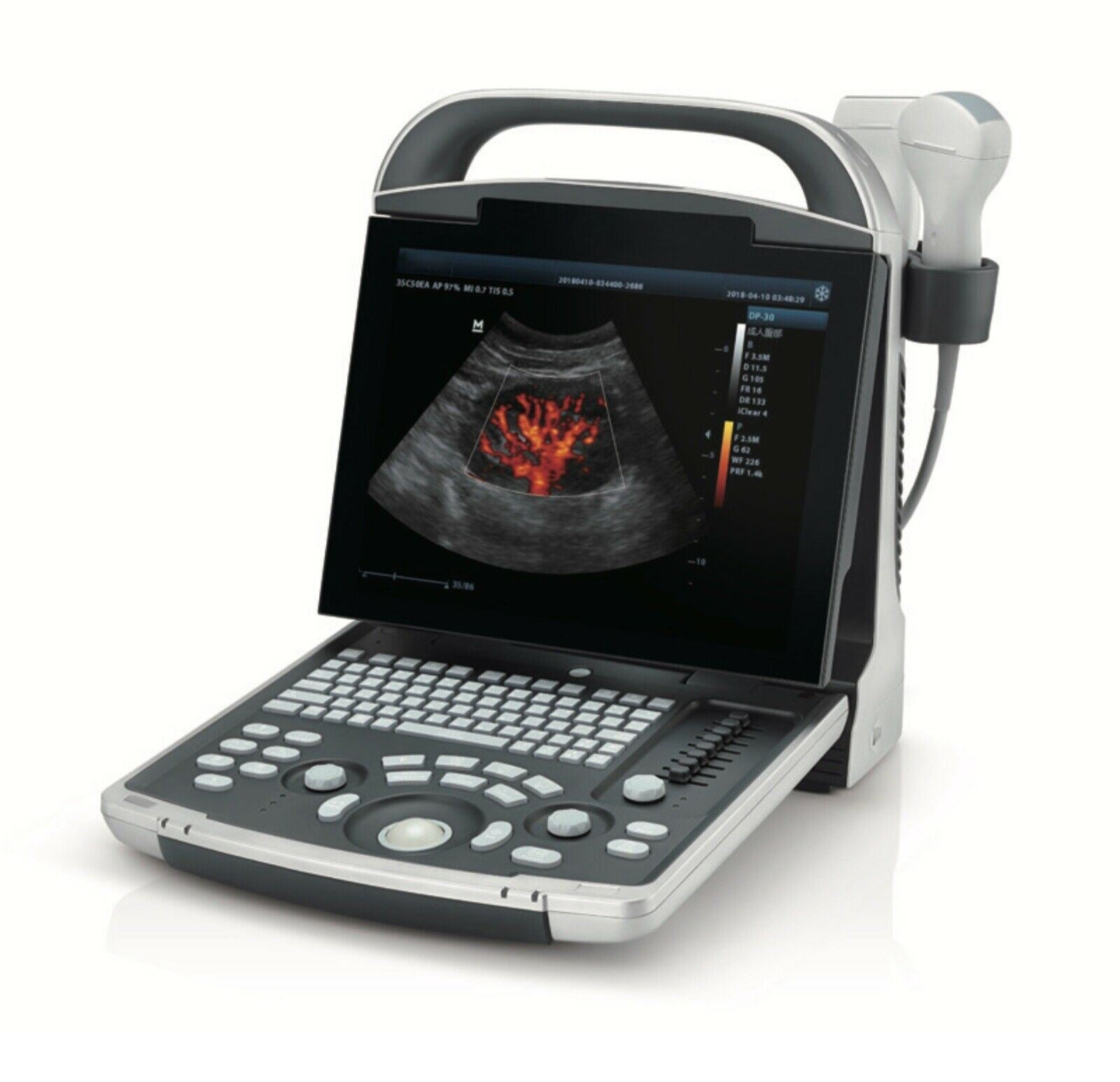 Erschwingliche Farbe Doppler Ultraschall Zwei Sonden Konvex & Lineare Anordnung DIAGNOSTIC ULTRASOUND MACHINES FOR SALE